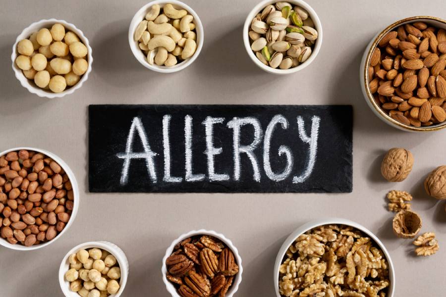 Clínica de Alergología en Barcelona: la incertidumbre de las alergias alimentarias